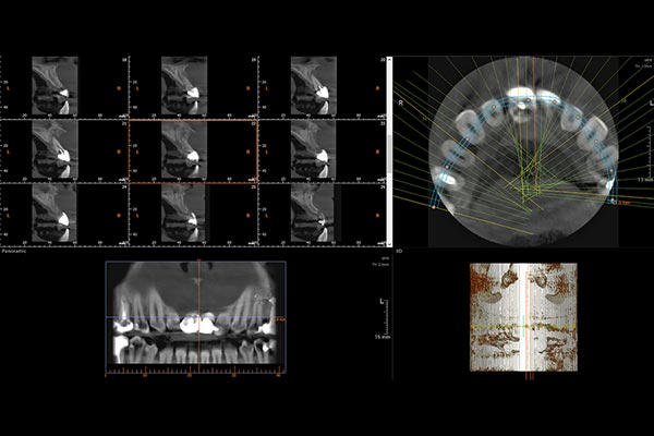 cone beam dental x ray image